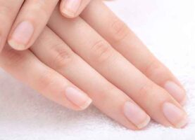 How to have healthy nails naturally