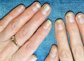 Do your nails turn yellow if you regularly apply nail polish?